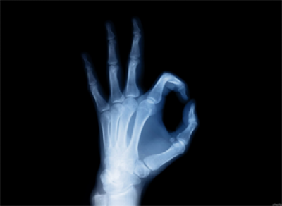 Российские ученые смогут печатать кости человека на 3D – принтере