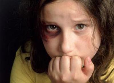 Жительница Вытегорского района избивала дочерей