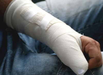Мужчина, сломавший руку в ДК Льнокомбината, отсудил у руководства 100 тыс.рублей
