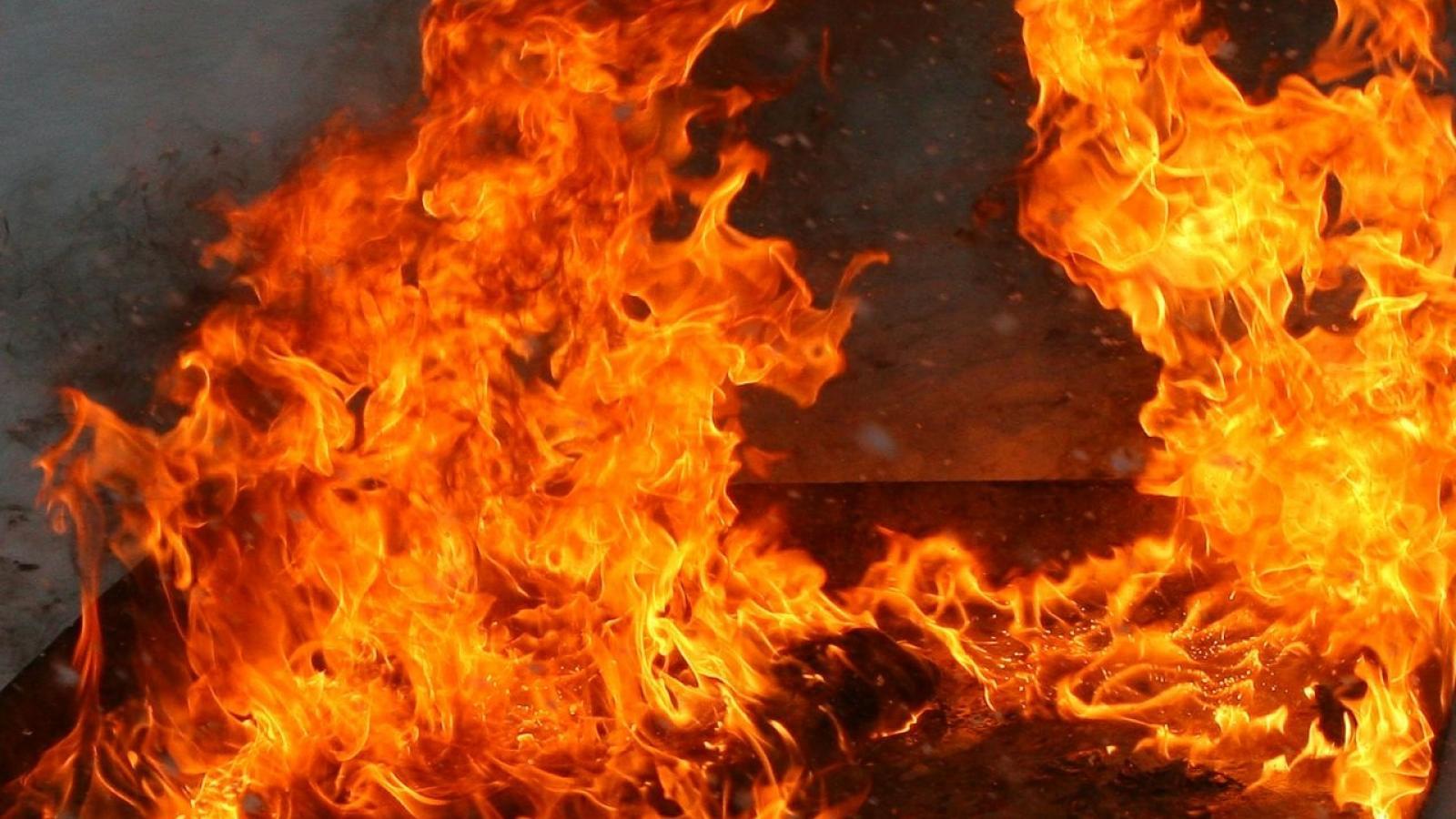 Неосторожное обращение с огнем: вологжанка получила ожоги 90% тела