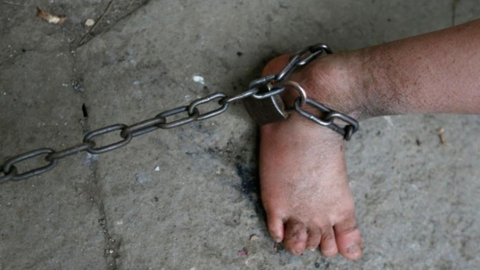 В Вологодской области неизвестные приковали мужчину цепью